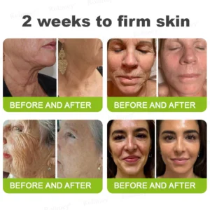 Rolimey® Botox & Vita-A Retinol Shot Wrinkle-Lift Tightening cream