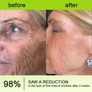 Rolimey® Botox & Vita-A Retinol Shot Wrinkle-Lift Tightening cream