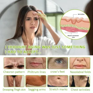 Rolimey® Botox & Vita-A Retinol Shot Wrinkle-Lift Tightening cream