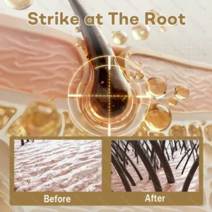 Healrize® Hair Regrowth Capsules