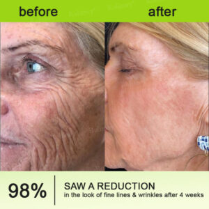 QIAWI™ Botulinum & Vita-A Retinol Shot Wrinkle-Lift Tightening cream