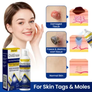 Healrize® ChillErase Gentle Bump Renewal Spray