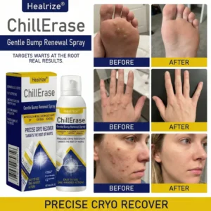 Healrize® ChillErase Gentle Bump Renewal Spray
