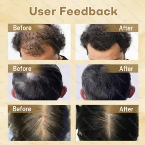 Healrize® Hair Regrowth Capsules