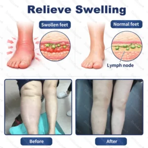 Healrize® LymphaPure Deep Drainage Therapy