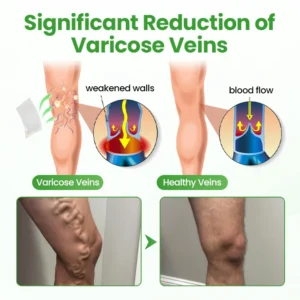 Healrize® VeinHeal Microneedle Patch