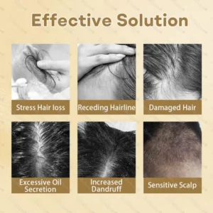 Healrize® Hair Regrowth Capsules