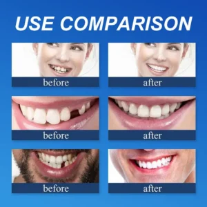 KLENIMORE™ Medical Full Denture with Strong Suctiond