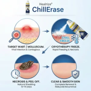 Healrize® ChillErase Gentle Bump Renewal Spray