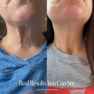 PINKLABS NECK FIRMING CREAM