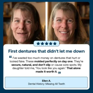 SEAGRIL™ Custom-Fit Full Functional Dentures