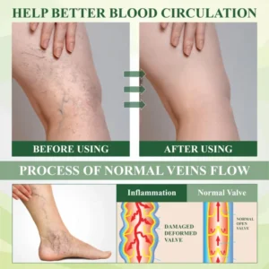 ATTDX® FluidEase Leg Therapy Edema Cream