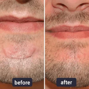 LBMLBM® Advanced Scar Repair and Skin Renew Cream