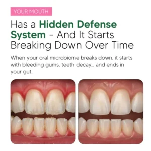 Oracare Oral Defence – Maximum Potency Oral Microbiome Restoration by