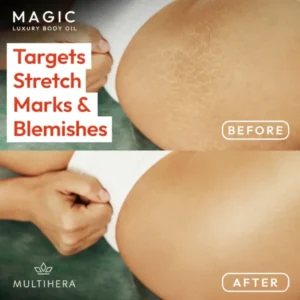 MultiThera Magic Body Oil – 100ml