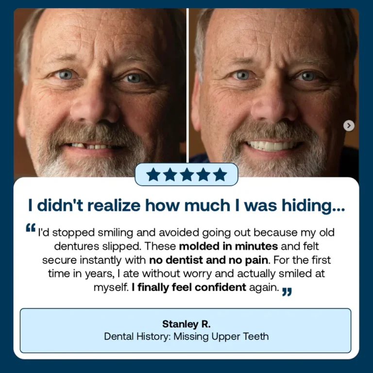 SEAGRIL™ Custom-Fit Full Functional Dentures