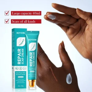 BQYOOM Scar Cream – Fade old scars, stretch marks & burns naturally