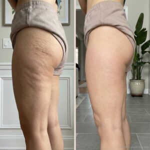 Birch & Bloom Anti-Cellulite Massage Oil Collagen