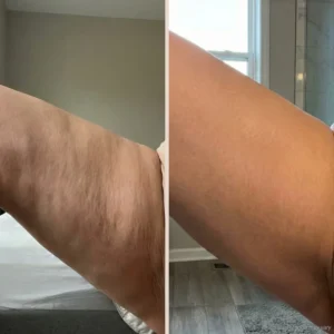 Birch & Bloom Anti-Cellulite Massage Oil Collagen