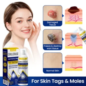 GFOUK® ChillErase Bump Renewal Spray