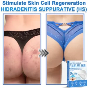 SkinPrikyn™ 2-in-1 Microneedle & Hydrocolloid Patch