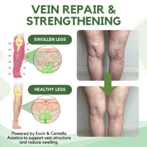 RZXEA™ Next-Gen Lymphatic Drainage & Vein Repair Cream
