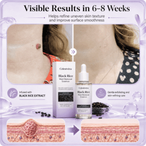 Celestvèra Black Rice Wart Removal Essence