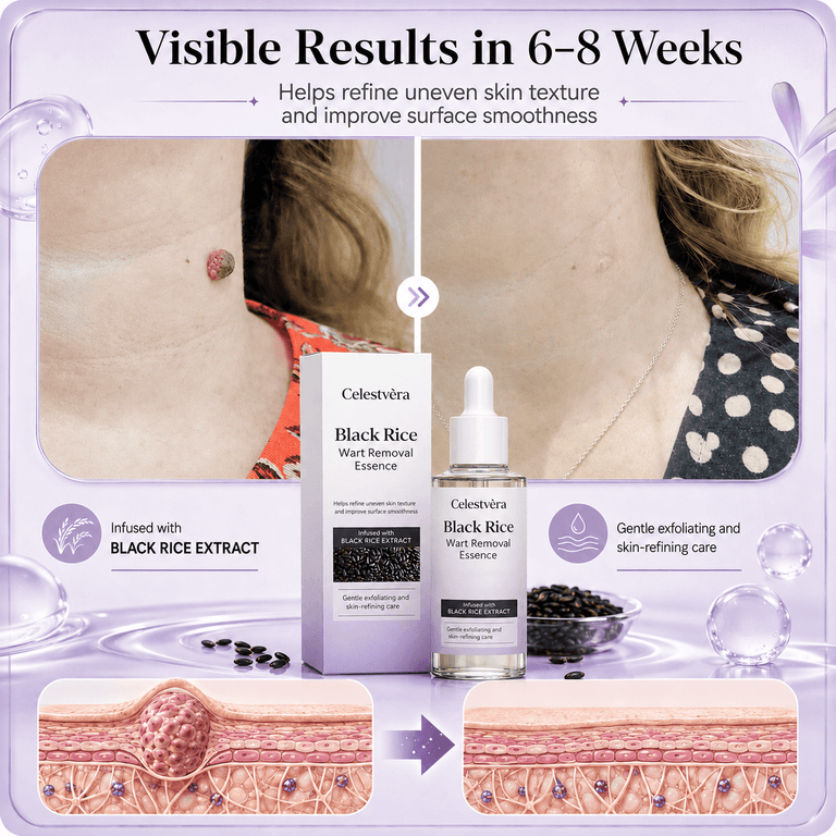 Celestvèra Black Rice Wart Removal Essence
