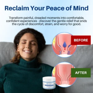 Cvreoz Hemorrhoid & Fissure Cream