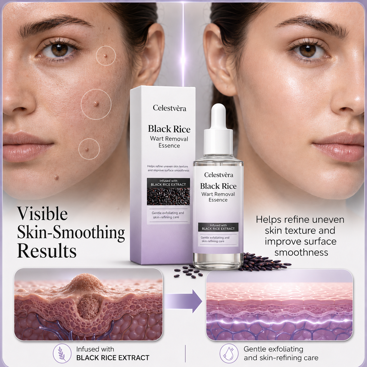 Celestvèra Black Rice Wart Removal Essence