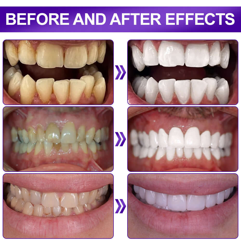 Luxevéria Tooth Cleaning Strips Brighter Smile