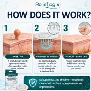 ReliefLogix Magnesium Microneedle Wart Removal Patch