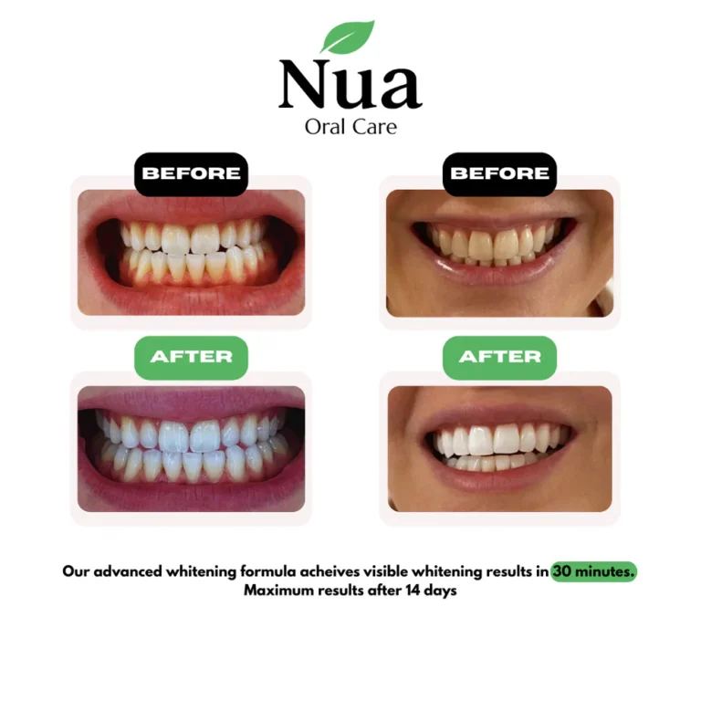 Nua Oral Care Teeth Whitening Strips