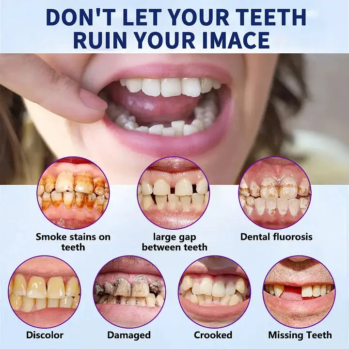 NESLEMY™- Advanced Customized Full Denture Set