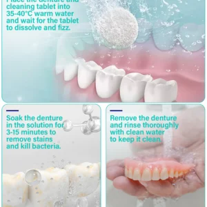 Ourlyard® Suction-fit Complete Denture